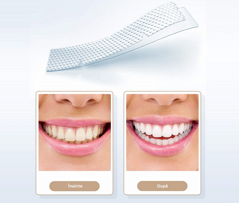 Fairywill® Whitestrips
